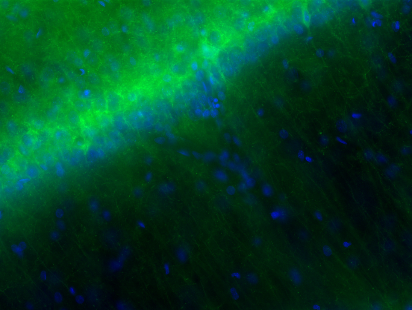 20× fluorescence micrograph of CA1 stratum pyramidale showing ArchT-GFP expression (green) against DAPI nuclear stain (blue)