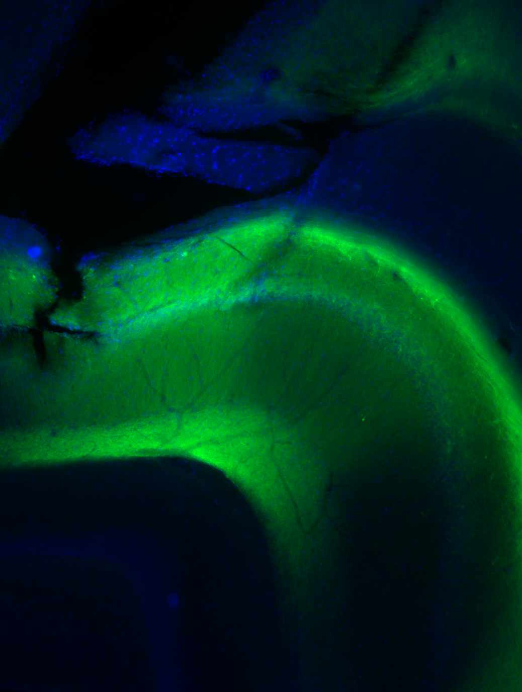 4× overview of hippocampal section showing ArchT-GFP expression arc across CA1